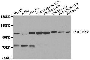 Western blot analysis of extracts of various cell lines, using PCDHA12 antibody. (PCDHA12 antibody  (AA 713-792))