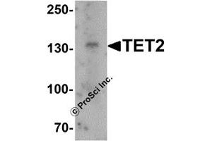 Western Blotting (WB) image for anti-Tet Methylcytosine Dioxygenase 2 (TET2) (N-Term) antibody (ABIN1031611) (TET2 antibody  (N-Term))