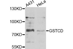 Western blot analysis of extracts of A431 and HeLa cells, using GSTCD antibody. (GSTCD antibody)