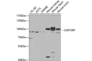 Western blot analysis of extracts of various cell lines, using CSRP2BP antibody (ABIN6127664, ABIN6139138, ABIN6139139 and ABIN6223242) at 1:1000 dilution. (CSRP2BP antibody  (AA 523-782))