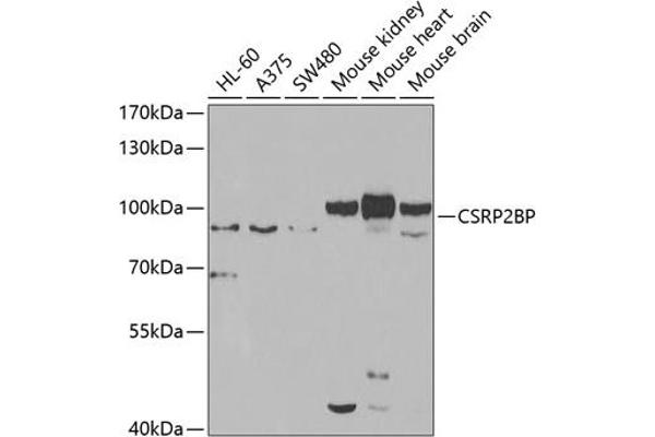 CSRP2BP antibody  (AA 523-782)