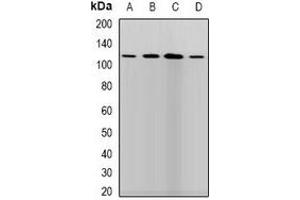 Western blot analysis of LLH expression in SKOV3 (A), HepG2 (B), mouse brain (C), mouse liver (D) whole cell lysates. (PLOD1 antibody)