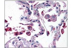 Human Lung: Formalin-Fixed, Paraffin-Embedded (FFPE) (TRIM7 antibody  (C-Term))