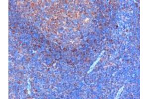 Image no. 2 for anti-Growth Factor Receptor-Bound Protein 2 (GRB2) (C-Term) antibody (ABIN374150)