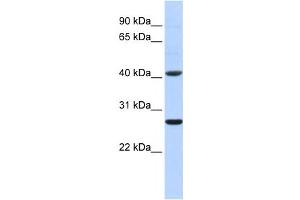 Western Blotting (WB) image for anti-Glutathione S-Transferase mu 5 (GSTM5) antibody (ABIN2459201) (GSTM5 antibody)