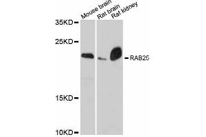 Western blot analysis of extracts of various cell lines, using RAB25 antibody (ABIN6290827) at 1:3000 dilution.