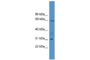 WB Suggested Anti-MEPE Antibody Titration:  0. (MEPE antibody  (Middle Region))