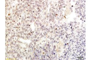 Formalin-fixed and paraffin embedded human embryonic cells labeled with Anti-GATA-4, Unconjugated (ABIN734333) followed by conjugation to the secondary antibody and DAB staining (GATA4 antibody  (AA 261-360))