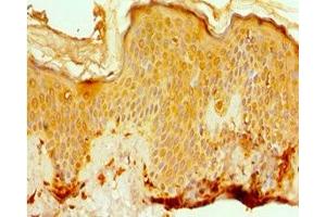 Immunohistochemistry of paraffin-embedded human skin tissue using ABIN7142077 at dilution of 1:100 (EFTUD2 antibody  (AA 1-205))