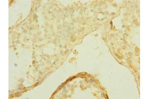 Immunohistochemistry of paraffin-embedded human testis tissue using ABIN7170303 at dilution of 1:100 (SLCO2B1 antibody  (AA 130-210))