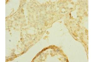 Immunohistochemistry of paraffin-embedded human testis tissue using ABIN7170303 at dilution of 1:100