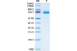 Mouse IL-20RA Protein on Tris-Bis PAGE under reduced condition. (IL20RA Protein (AA 33-253) (Fc Tag))