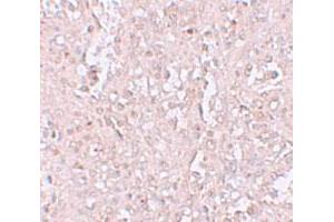 Immunohistochemical staining of human spleen cells with SLC39A13 polyclonal antibody  at 2.