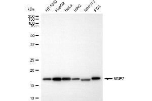 Western blotting analysis using NME2 antibody (ABIN7799681).