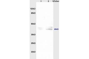 Lane 1: mouse embryo lysates Lane 2: mouse brain lysates probed with Anti TNFAIP5/Pentraxin 3 Polyclonal Antibody, Unconjugated (ABIN714686) at 1:200 in 4 °C. (PTX3 antibody  (AA 151-250))