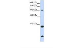 Image no. 1 for anti-Ring Finger Protein 20 (RNF20) (AA 576-625) antibody (ABIN6738066) (RNF20 antibody  (AA 576-625))