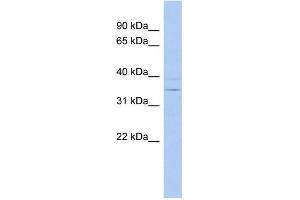 ASPDH antibody  (N-Term)