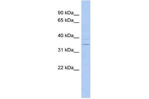 WB Suggested Anti-ASPDH Antibody Titration: 0. (ASPDH antibody  (N-Term))