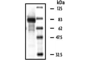 Western Blotting (WB) image for Macrophage Stimulating 1 (Hepatocyte Growth Factor-Like) (MST1) (Active) protein (ABIN2669400) (MST1 Protein)