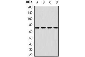 Western blot analysis of SDHA expression in HepG2 (A), MCF7 (B), mouse liver (C), mouse stomach (D) whole cell lysates. (SDHA antibody)