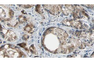 ABIN6277180 at 1/100 staining Human prostate tissue by IHC-P. (ABCC4 antibody)