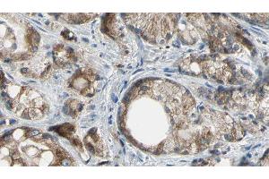 ABIN6277180 at 1/100 staining Human prostate tissue by IHC-P. (ABCC4 antibody)