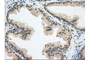 Immunohistochemical staining of paraffin-embedded pancreas tissue using anti-ERCC1 mouse monoclonal antibody.
