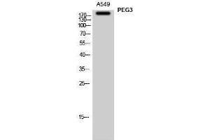 Western Blotting (WB) image for anti-Paternally Expressed 3 (PEG3) (Internal Region) antibody (ABIN3186389) (PEG3 antibody  (Internal Region))
