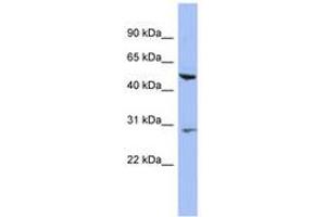 Image no. 1 for anti-Keratin 75 (KRT75) (N-Term) antibody (ABIN6744317) (Keratin 75 antibody  (N-Term))