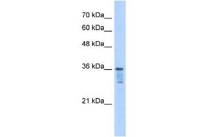 LZTFL1 antibody used at 2. (LZTFL1 antibody  (C-Term))