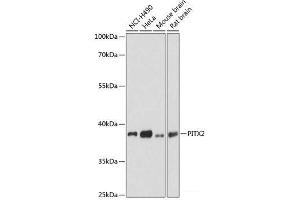 Western blot analysis of extracts of various cell lines using PITX2 Polyclonal Antibody at dilution of 1:3000. (PITX2 antibody)