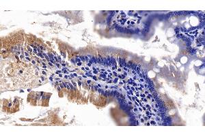 Detection of AXIN in Rat Small intestine Tissue using Polyclonal Antibody to Axis Inhibition Protein (AXIN) (Axin antibody  (AA 618-827))