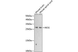Western blot analysis of extracts of various cell lines, using NOG antibody (ABIN6128385, ABIN6144701, ABIN6144702 and ABIN6224318) at 1:1000 dilution. (NOG antibody  (AA 28-232))