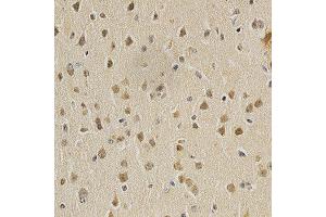 Immunohistochemistry (IHC) image for anti-Histone Deacetylase 6 (HDAC6) (AA 1-200) antibody (ABIN3022457)
