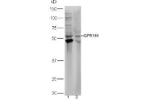 Lane 1: HepG2 lysates Lane 2: HL-60  lysates probed with Rabbit Anti-GPR161 Polyclonal Antibody, Unconjugated (ABIN2174751) at 1:300 overnight at 4 °C. (GPR161 antibody  (AA 121-220))