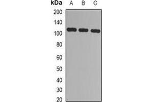 Western blot analysis of CBLB expression in Jurkat (A), 293T (B), mouse spleen (C) whole cell lysates. (Cbl Proto-Oncogene B, E3 Ubiquitin Protein Ligase (CBLB) antibody)