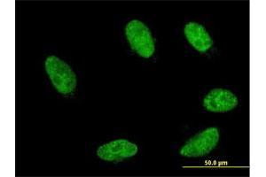 Immunofluorescence of monoclonal antibody to GBX2 on HeLa cell. (GBX2 antibody  (AA 114-182))
