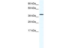Western Blotting (WB) image for anti-SRY (Sex Determining Region Y)-Box 7 (SOX7) antibody (ABIN2461476)