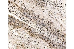 IHC analysis of SSB using anti-SSB antibody (ABIN7602125).
