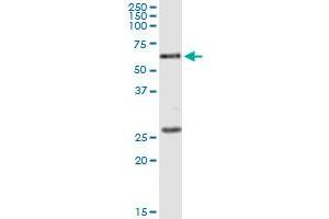 Immunoprecipitation of POLK transfected lysate using anti-POLK monoclonal antibody and Protein A Magnetic Bead , and immunoblotted with POLK MaxPab rabbit polyclonal antibody. (POLK antibody  (AA 1-472))