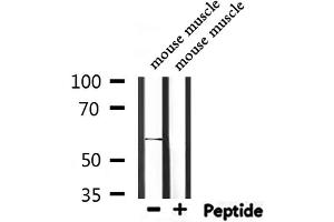 Western blot analysis of extracts from mouse muscle, using BMPR1A Antibody.