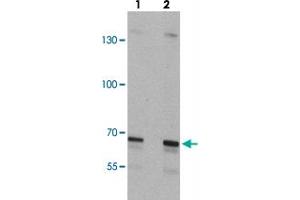Western blot analysis of SLC27A6 in A-20 cell lysate with SLC27A6 polyclonal antibody  at (lane 1) 1 and (lane 2) 2 ug/mL. (SLC27A6 antibody  (N-Term))