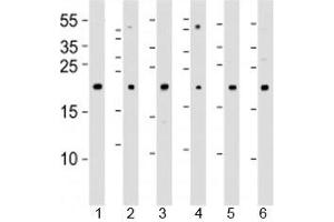 Western blot analysis of lysate from 1) 293T, 2) HeLa, 3) Jurkat, 4) Y79 cell line , 5) mouse spleen and 6) rat kidney tissue lysate using DHFR antibody at 1:1000. (Dihydrofolate Reductase antibody  (AA 1-50))