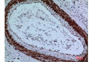 Immunohistochemistry (IHC) analysis of paraffin-embedded Human Brain, antibody was diluted at 1:100. (CYP11A1 antibody  (C-Term))