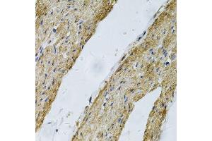 Immunohistochemistry of paraffin-embedded human smooth muscle using VCL Antibody. (Vinculin antibody  (AA 767-1066))