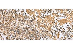 Immunohistochemistry of paraffin-embedded Human tonsil tissue using NDUFB3 Polyclonal Antibody at dilution of 1:25(x200) (NDUFB3 antibody)