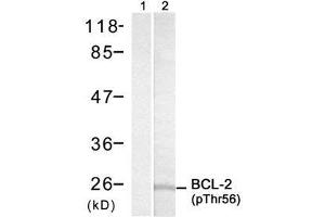 Image no. 1 for anti-B-Cell CLL/lymphoma 2 (BCL2) (pThr56) antibody (ABIN273336) (Bcl-2 antibody  (pThr56))