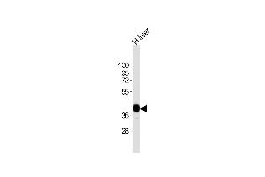 Anti-AGXT Antibody (Center)at 1:8000 dilution + human liver lysates Lysates/proteins at 20 μg per lane. (AGXT antibody  (AA 96-125))