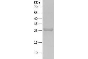Western Blotting (WB) image for 6-phosphogluconolactonase (PGLS) (AA 1-258) protein (His tag) (ABIN7121626) (PGLS Protein (AA 1-258) (His tag))