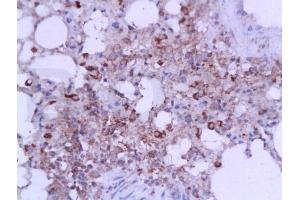 Formalin-fixed and paraffin embedded mouse lung tissue labeled with Anti-IL-6(mo, rat) Polyclonal Antibody, Unconjugated (ABIN728083) at 1:200, followed by conjugation to the secondary antibody and DAB staining (IL-6 antibody  (AA 111-150))